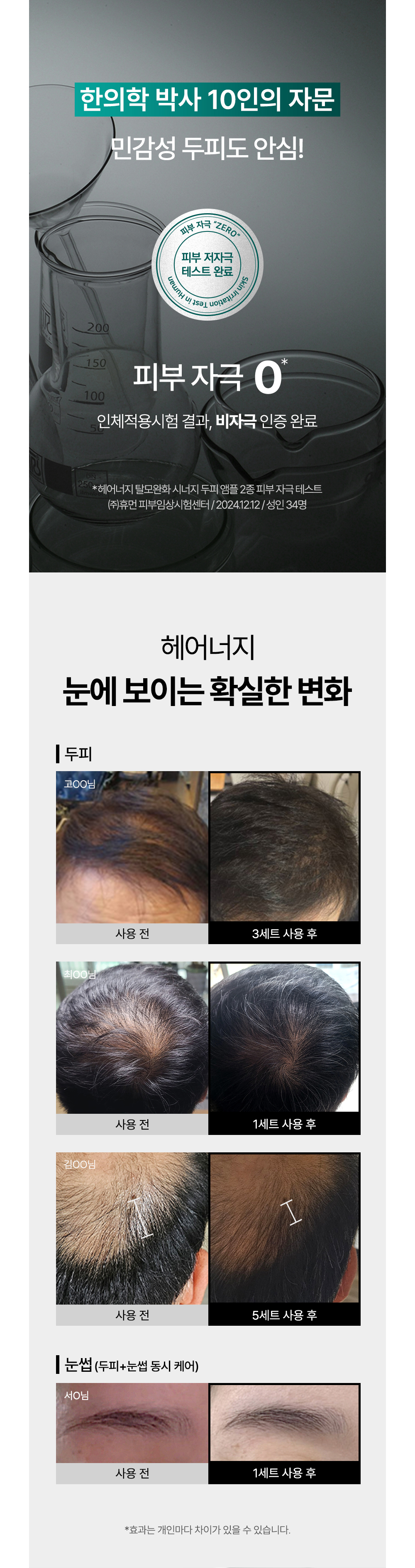 악세사리 상품 이미지-S40L11